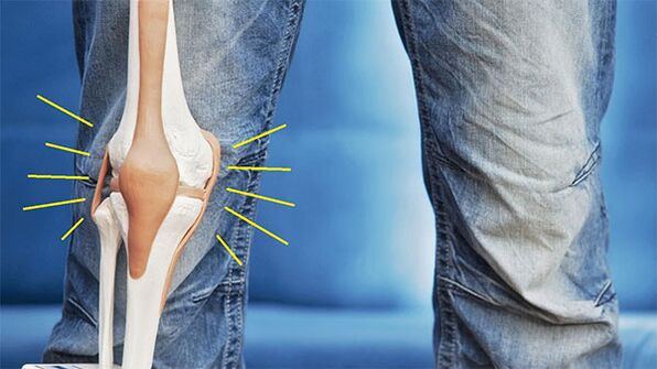 ból stawu kolanowego