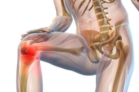 Ból stawu kolanowego z artrozą