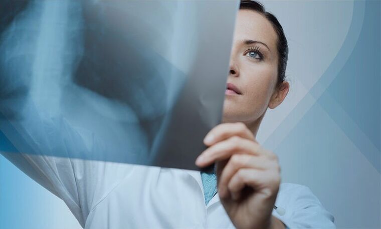 lekarz bada migawkę odcinka szyjnego kręgosłupa z osteochondrozą